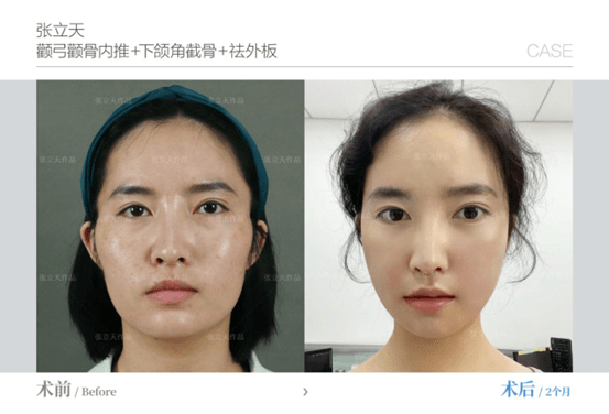 黑莓手机和华为哪个好
:李继华和张立天比哪个好